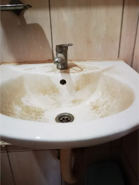 כיור רחצה עם כתמי אבנית וצהבת — לפני
